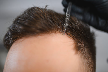 Man applying rejuvenating serum directly to his scalp using a pipette, targeting thinning hair and...