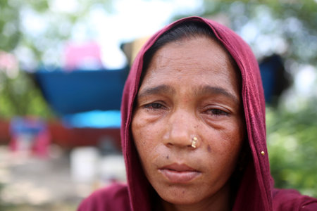 NEW DELHI, INDIA - JULY 24: Flood affected people living in temporary tent sites are suffering with...