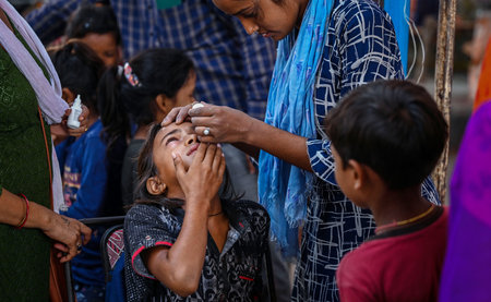 NEW DELHI, INDIA - JULY 24: An NGO volunteers seen putting eye drops in the eyes of the people who are affected with eye flu at Relief camp in the Mayur Vihar area amid rise in the water levels of Yamuna River, on July 24, 2023 in New Delhi, India. (Photoのeditorial素材