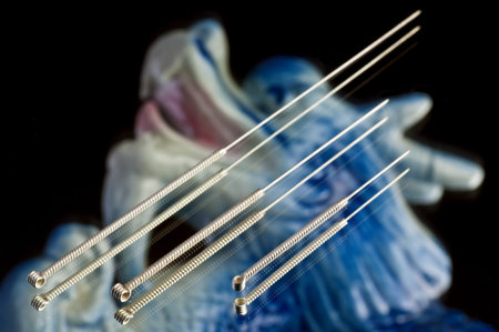 acupuncture needle