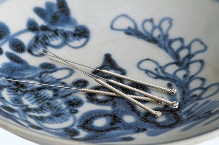 acupuncture needleの写真素材