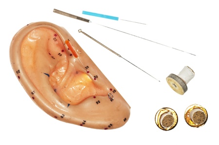 ear acupunctureの写真素材