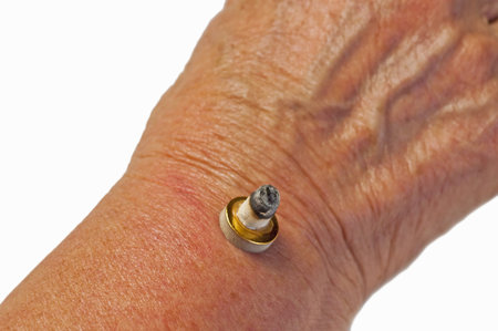 Moxibustion, chinese warming therapy