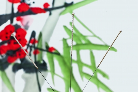 acupuncture needleの写真素材