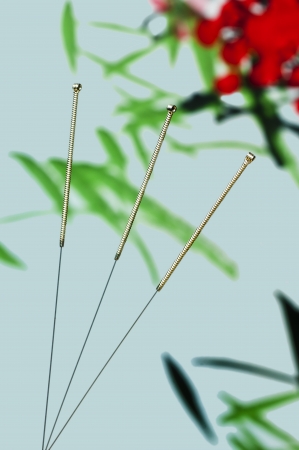 acupuncture needleの写真素材