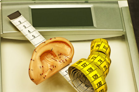acupuncture for weight loss