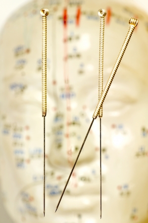 Acupuncture needles over head modelの写真素材