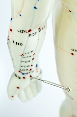 acupuncture demonstration on model の写真素材