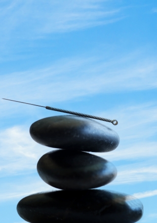Acupuncture needleの写真素材