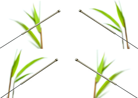 Acupuncture needleの写真素材