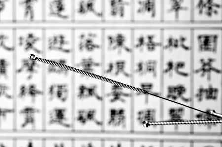 acupuncture needlesの写真素材