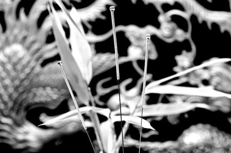 acupuncture needlesの写真素材