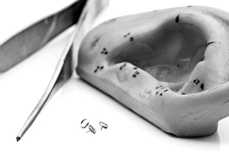 acupuncture needles with ear modelの写真素材
