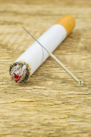 Acupuncture to stop smokingの写真素材