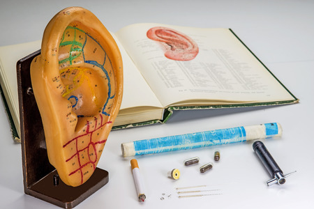 Acupuncture to stop smokingの写真素材