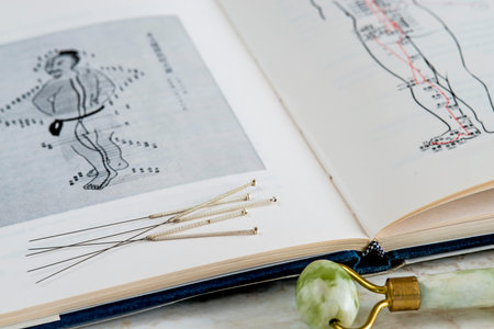 acupuncture needlesの写真素材