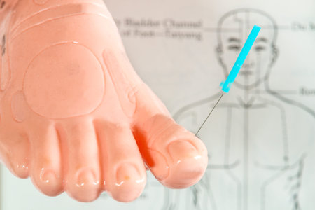 acupuncture demonstration on foot modelの写真素材