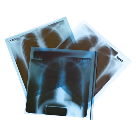 Film x-ray on white background 