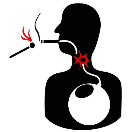 Concept of unhealthy cigarette smoke bomb on white backgroundのイラスト素材