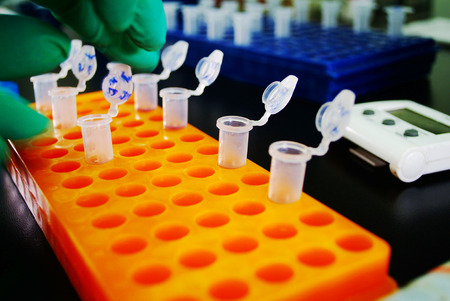 DNA in test tubeの写真素材