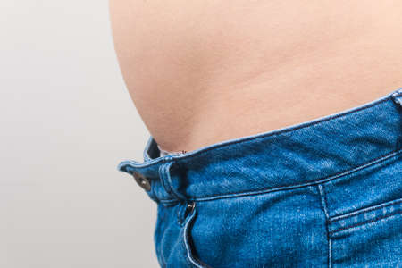 girl with a cellulitis on a stomachの写真素材