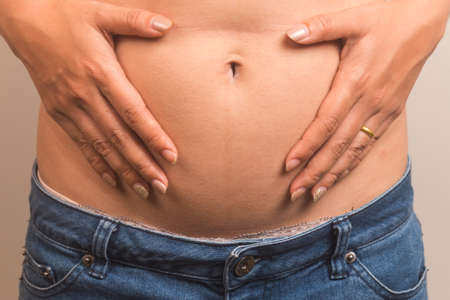 girl with a cellulitis on a stomachの写真素材