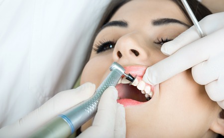 young women to the dentist in the dental chair sits next to a doctor to do the dentist to see if his teeth were okayの写真素材