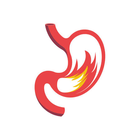 Heartburn flat icon. Fire in stomach. Intestinal disease. Sick stomach. Gastric gases. Anatomy human, internal organ. Vector illustration flat design. Concept healthcare. Painful digestion system.のイラスト素材