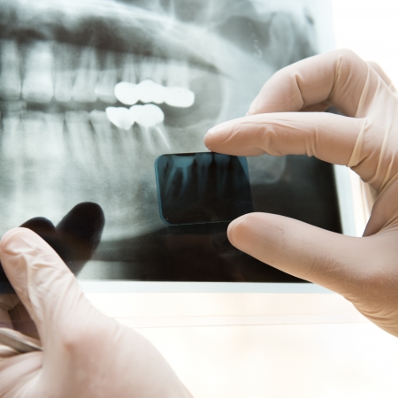 Panoramic dental X-Ray in hand.の写真素材
