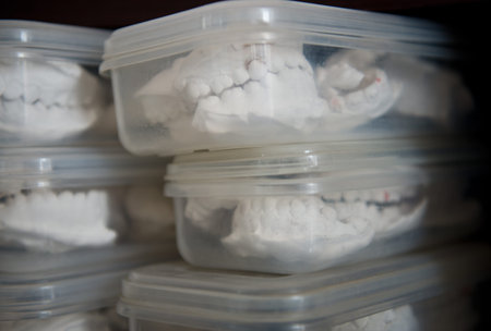 Group of dental molds in case.の写真素材