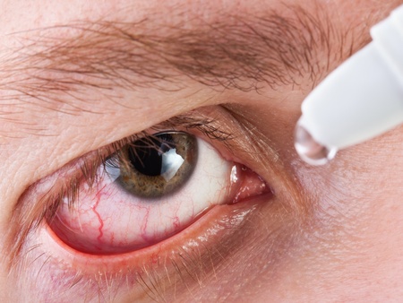 Medicine healthcare liquid eyedropper on human eyeの写真素材