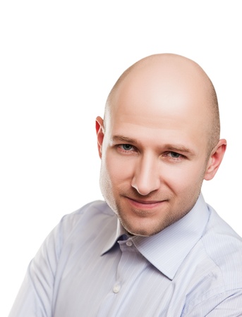 Human alopecia or hair loss - smiling adult man bald headの写真素材