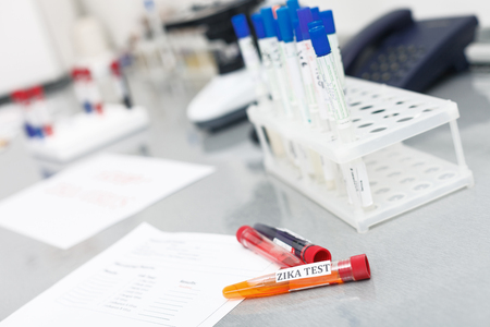 Close up of zika test samples and flasks on desk in laboratoryの写真素材