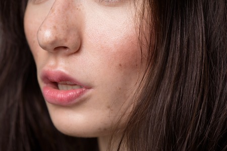 skincare and beauty concept, face with freckles