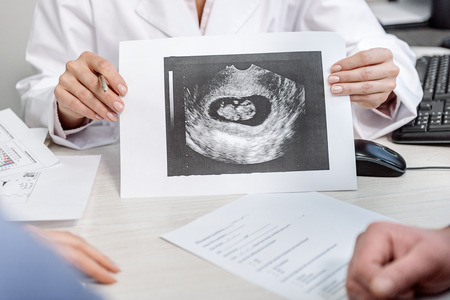 Precise uzi picture of childの写真素材