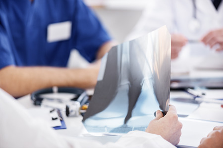 Physician holding shadow-radiograph at conference in clinicの写真素材