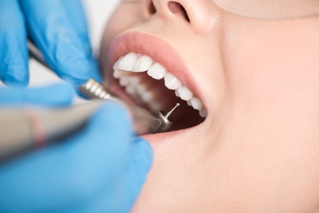 Odontologist curing teeth of womanの写真素材