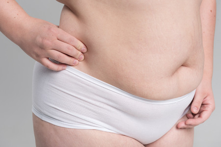 Young thick woman with big abdomenの写真素材