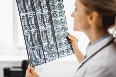 Focused on work. Close up of x-ray image in woman handsの写真素材