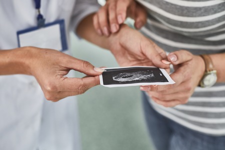 Close up of baby sonogram in female gynecologist hands. Lady with watch gently touching doctor arm