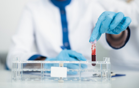 Professional facility investigations in healthcare system. Close up portrait of female laboratory worker putting test tube with blood into medicine boardの写真素材