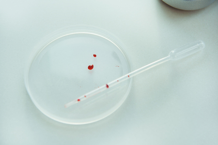 Drops of blood with a pipette isolated on white backgroundの写真素材