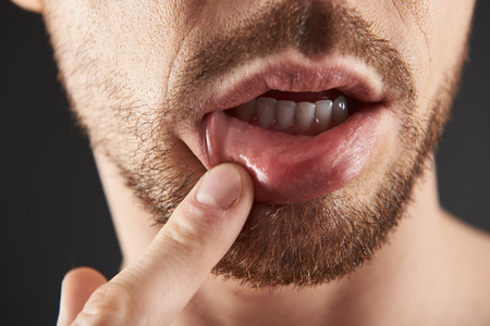Close up of bearded young man touching his lip with fingerの写真素材