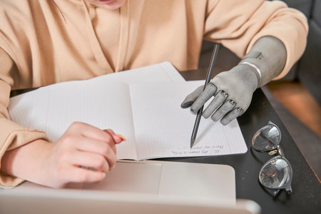 Girl with prosthesis arm sitting at table and writing her homeworkの写真素材