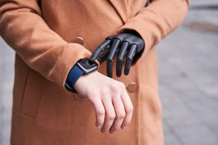 Woman with implant arm checking time from smart watch