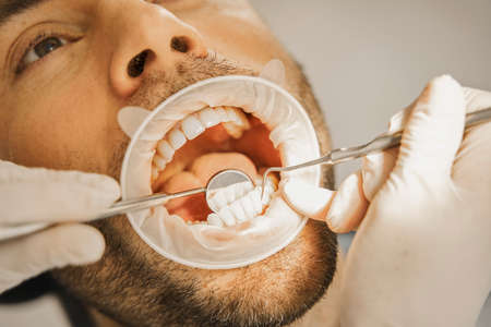 Doctor is using mirror for better teeth examinationの写真素材