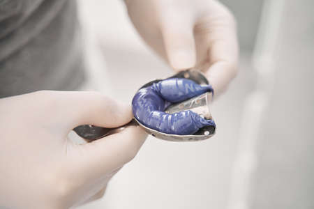 Dentists hands holding teeth impression instrumentsの写真素材