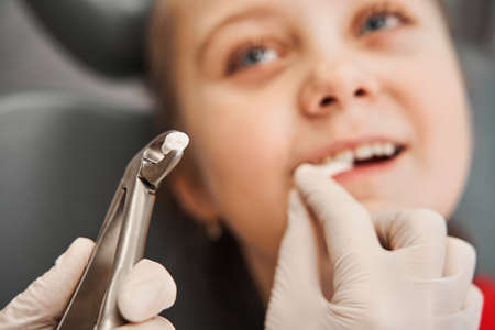 Child dentistâs hands with dental forcepsの写真素材