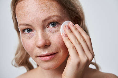 Freckled attractive woman cleaning her face with a cotton pad