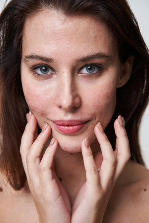 Woman with problematic skin and long brown hair looking at the cameraの写真素材